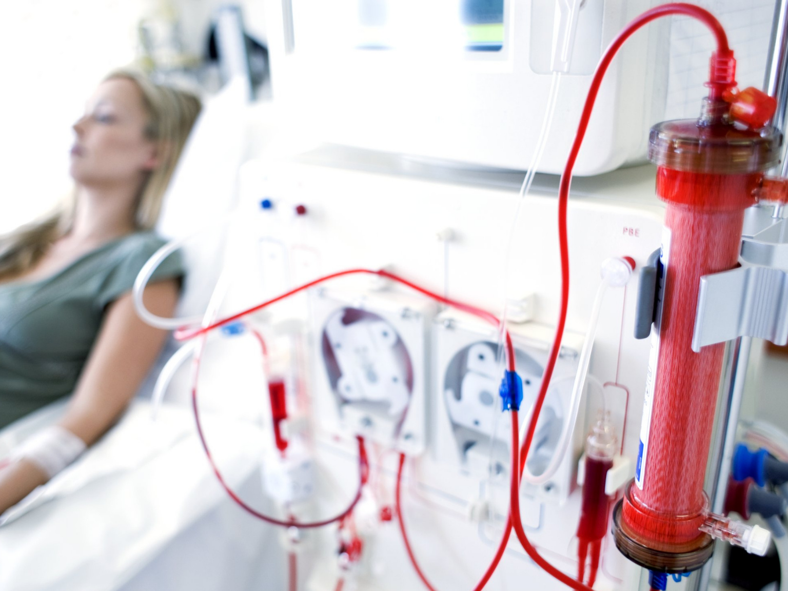 kidney_transplant